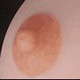 Areola Color 6YE-Areola1