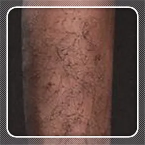 Lāʻau Arm IrSilicone-lauʻau lima（+$160）