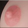 Areola ពណ៌ Rosretty-Areola-Color-Pink