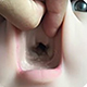 Tipus de boca amb textura