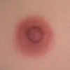 Areola रंग Zelex-Areola-3