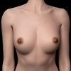 Areola magnitudo Zelex-Areola-size-L
