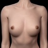 Areola magnitudo Zelex-Areola-magnitudo-M