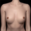 Areola magnitudo Zelex-Areola-size-s