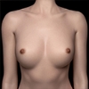 Areola izmērs Zelex-Areola-size-s