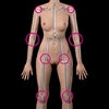 Joint Tightness Zelex-Joint-Tightness-Limb-Weakn