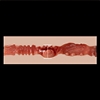 Diameter vaginalis zelex-Vaginal-Diameter-3cm